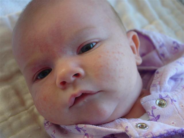 Anna - 5 weeks 008 (Small)