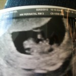 Our little bean in February.